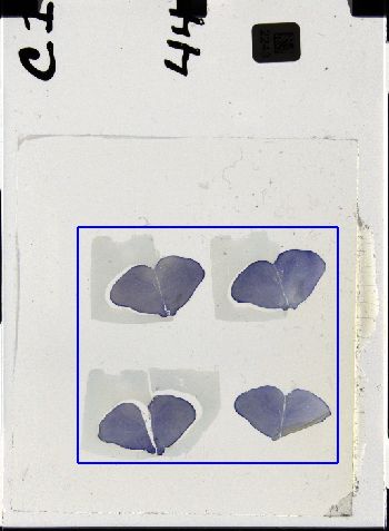 Media type: image; Special Collections 3298   shows specimen_part histological serial section;
